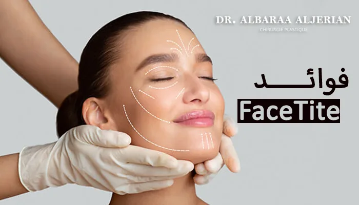 فوائد تقنية فيس تايت لشد الوجه والرقبة FaceTite