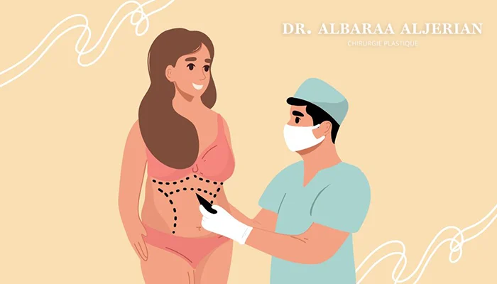 مدة التعافي بعد شفط الدهون 360 درجة