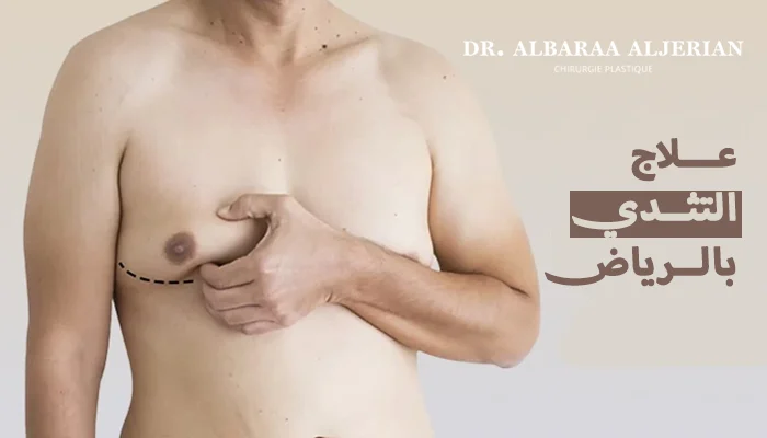 علاج التثدي عند الرجال بالرياض