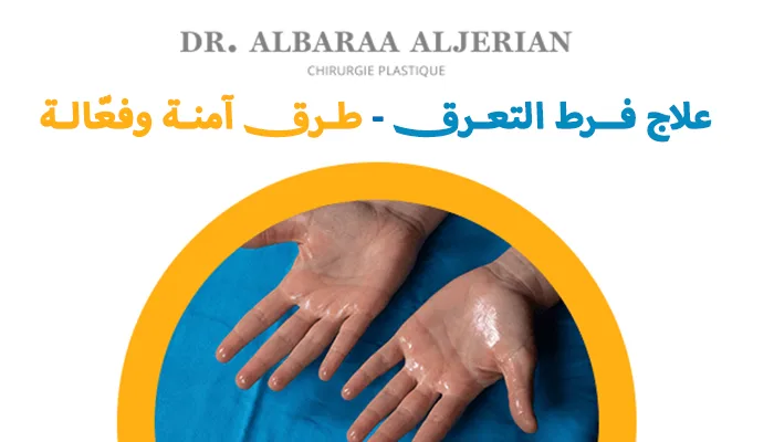 علاج فرط التعرق طرق آمنة وفعّالة