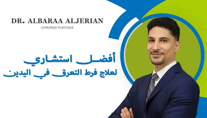 أفضل استشاري لعلاج فرط التعرق في اليدين