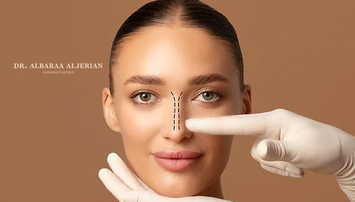 تجميل الانف بالخيوط في الرياض