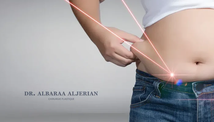 عملية شفط الدهون بالليزر كم تكلف؟