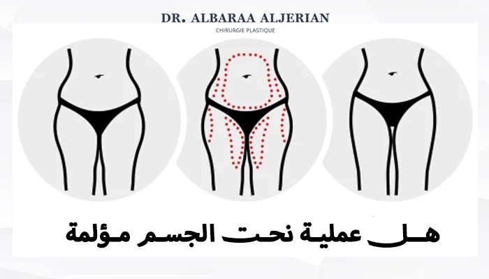 هل عملية نحت الجسم مؤلمة