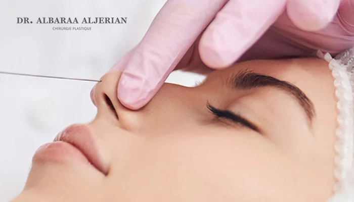 تجميل الأنف بدون جراحة بالخيوط