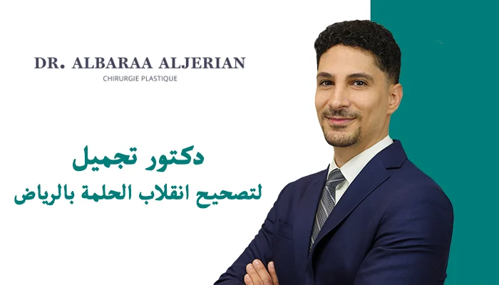 دكتور تجميل لتصحيح انقلاب الحلمة بالرياض